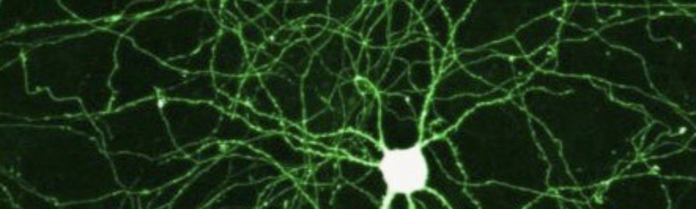 Lab-Grown Cluster of Neurons Develops “Sentience”, Plays Video Games ...